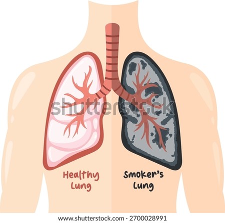 Healthy Lung vs Smoker's Lung The Impact of Smoking