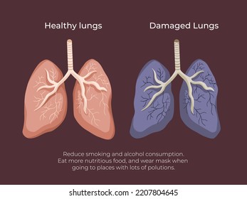 Healthy Lungs And Damaged Black Lungs, Human Breathing Organ. Result Of Smoking And Too Much Alcohol Consumption. Medical Vector Illustration With Cartoon Flat Art Style Drawing Comparison Poster.