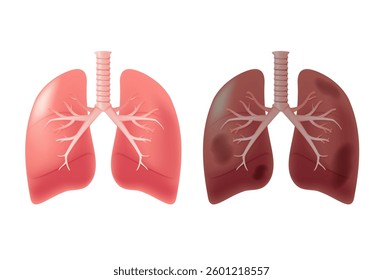 Healthy lungs and disease lungs on white isolate. Autopsy medical concept. Cancer and smoking problem. Human lungs 3D illustration. Internal organs isolated medical concept, healthcare, healthy lifest
