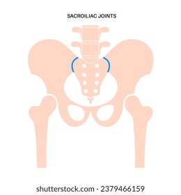 Healthy sacroiliac joints medical poster. Lower spine and pelvis connection. Sacrum and ilium cartilages. Backbone, legs and hip anatomy, skeletal flat vector illustration for clinic or education