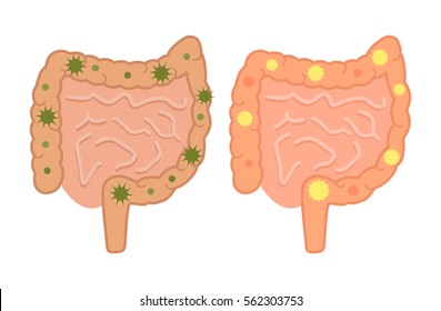 Healthy and sick gastrointestinal tract, and various bacteria. Icon of the intestinal flora in a flat style. vector illustration