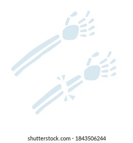 Healthy and sick hand. Broken bone. Element of hospitals and clinics. Flat cartoon illustration. Trauma and medical care