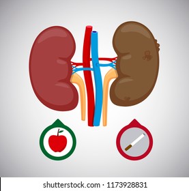 Healthy and sick kidney vector Illustration. Sick human internal kidneys organ. kidney cancer.