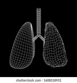 Healthy and sick lung with trachea bronchi internal organ human. Pulmonology medicine science technology concept. Wireframe low poly mesh vector illustration