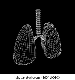 Healthy and sick lung with trachea bronchi internal organ human. Pulmonology medicine science technology concept. Wireframe low poly mesh vector illustration
