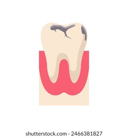 Dientes sanos y enfermos en la boca de la encía. Sucio y limpio. Dos dientes de dibujos animados iconos de personajes. Dientes blancos sanos y con un agujero. Diseño plano de Ilustración vectorial. Aislado sobre fondo blanco.