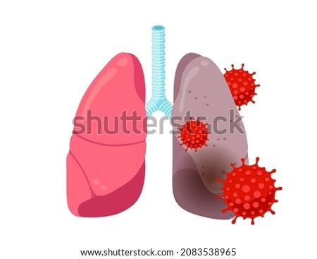 Healthy and sick unhealthy lungs with coronavirus infection disease. Human respiratory system internal organ with pneumonia. Infected COVID-19 lung disease vector eps illustration. Pandemic damage