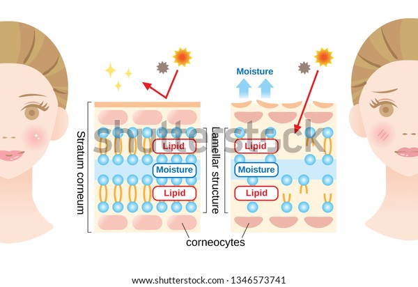 healthy skin and dry skin diagram with woman\
face. structure of stratum corneum and lamellar structure, which\
play the protective role for skin barrier functions. beauty and\
skin care concept\

