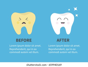 Healthy smiling tooth icon. Sining star. Crying yellow bad ill teeth. Before after Infographic Template with text. Cute character. Oral dental hygiene. Baby background. Flat design. Vector