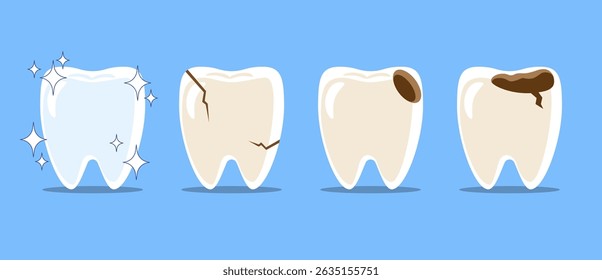 Healthy teeth, Cracked tooth, dental caries or tooth decayed . Set of flat design cartoon illustration . Isolated on Blue background . Vector .