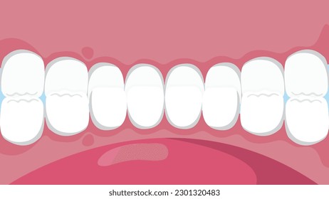 Healthy Teeth Inside View an Open Jaw Dental Care and Orthodontic Concept