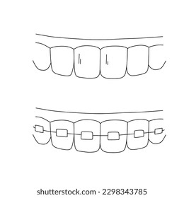 Healthy teeth sketch. Tooth braces outline doodle icon. Dentistry, stomatology and dental care concept. Vector hand drawn sketch isolated on white background.