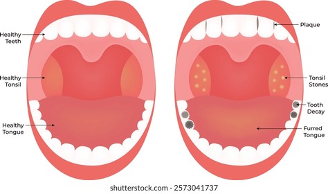 Healthy Teeth Tooth Deacy Science Design Vector Illustration Diagram