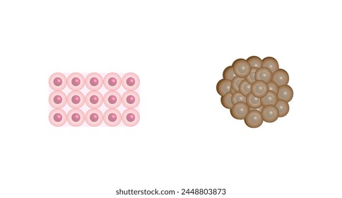 Healthy tissue and Malignant (cancerous) tissue. Cancer disease development. Malignant tumor. Medical biological, scientific vector illustration.