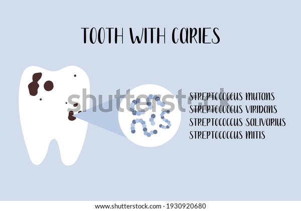 Healthy tooth and tooth\
with caries. Plaque bacteria: Streptococcus mutans, Streptococcus\
viridans. Oral care. Dental cavity, teeth hygiene. Vector flat\
cartoon illustration