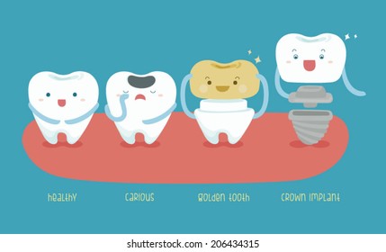 Healthy tooth ,carious ,golden tooth and crown implant of dental