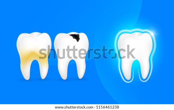 Gesunder Zahn Zahn Und Zahn Mit Stock Vektorgrafik Lizenzfrei