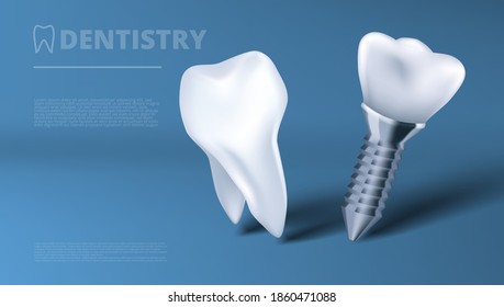 Healthy Tooth And Dental Implant Clinic Advertising Template. EPS10 Vector