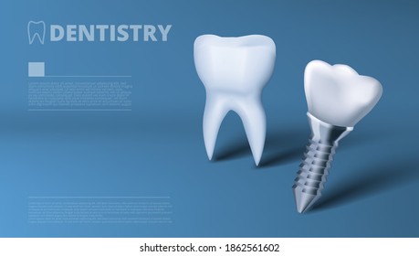 Healthy Tooth And Dental Implant Clinic Advertising Template. EPS10 Vector