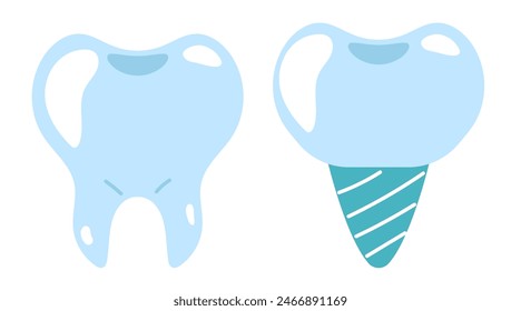 Healthy tooth and implant isolated concept. Vector flat graphic design illustration