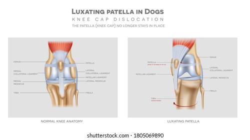 Healthy And Unhealthy Dog's Knee Joint, The Medial Luxating Patella Or Knee Cap Dislocation Illustration.