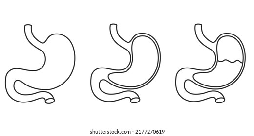 Gesunder und ungesunder, leerer und voller menschlicher Magen. Anatomie des Verdauungssystems. Vektorgrafik einzeln auf weißem Hintergrund.