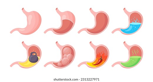 Healthy and unhealthy, empty and full human stomach, icons set. Nutrition, stomach pain, heartburn, heaviness, bloating. Anatomy of the digestive system. vector