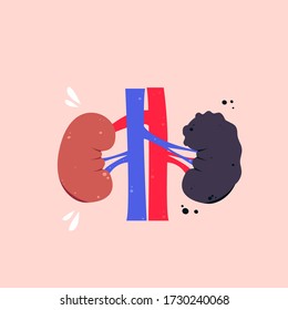 Healthy And Unhealthy Kidneys Vector Illustration. Kidney Infection
Drawing. Urolithiasis, Fibrosis Hand Drawn Concept.