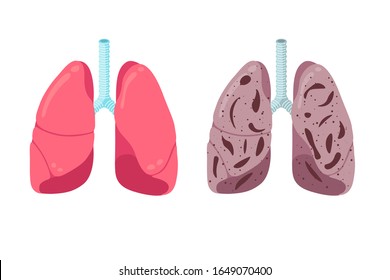Healthy and unhealthy lungs compare concept. Human respiratory system internal organ strong and pneumonia inflammation. Healthcare respiration medical condition anatomy vector illustration