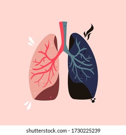 Healthy and unhealthy lungs vector illustration. Smoker's disease
drawing. Contaminated respiratory system hand drawn concept.