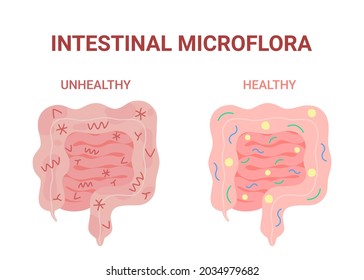 Healthy And Unhealthy Microflora Intestinal, Good And Bad Nutrition Gut. Harmful And Beneficial Bacteria In Inside Gastrointestinal Organ. Inflammation And Pain Internal Digestive Bowel. Vector