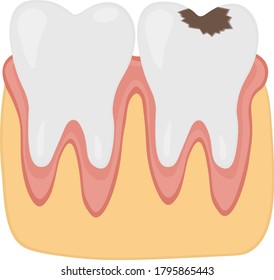 Healthy and unhealthy teeth dental treatment stomatology vector illustration.