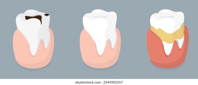 Healthy and unhealthy tooth. Isometric vector illustration.