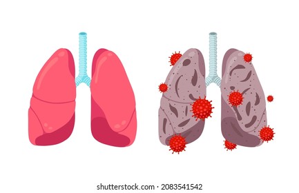 Healthy vaccine protection and unhealthy lungs with coronavirus infection disease. Human respiratory system internal organ with corona virus pneumonia. Infected COVID-19 lung disease eps illustration