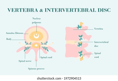 Healthy vertebrae and intervertebral discs, patient-friendly diagram