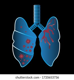 healthy and virus Lunges organ vector design