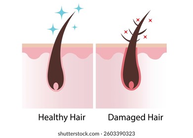 Healthy vs Damaged Hair Follicle – Hair Care and Scalp Health Vector