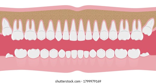 Healthy white human teeth in a row. Beautiful, even teeth with roots. The gums are cut to the bone. Structure of the jaw.Infographic elements for dentists and orthodontists. A flat-style banner.Vector