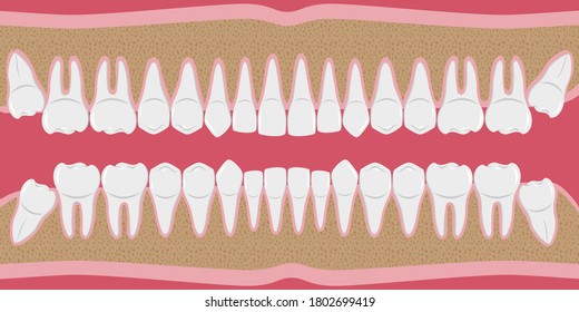 Healthy white human teeth in a row. Beautiful, even teeth with roots. The gums are cut to the bone. Structure of the jaw. Infographic elements for dentists and orthodontists. flat-style banner. Vector