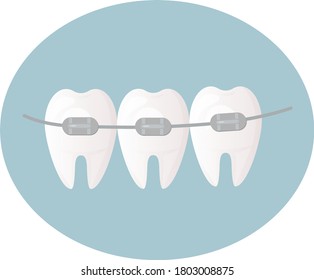 healthy white and straight teeth with braces. Dental care service - Orthodontic treatment and straightening of teeth. Flat vector illustration