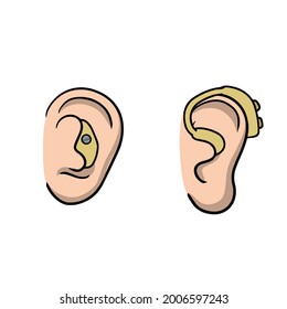 Hearing aid. Audiphone in ear. Set of Cartoon illustration. Hearing problems and disabilities