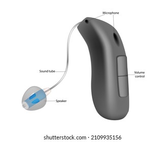 Hearing Aid BTE devices with an external receiver. Treatment and prosthetics in otolaryngology. Deafness and hearing loss. Realistic