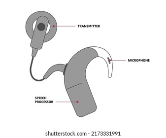 Hearing Aid Ear Child Deaf Signal Baby Inner Middle Bone Loss Outer Canal Birth Meniere's Cochlea Brain Implantation Test Exam