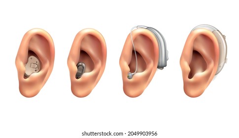 Hearing aid ear realistic set of four isolated images with human ears with hanging electronic appliances vector illustration