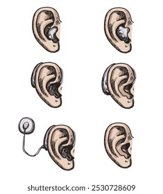 hearing aid ear set of different types device illustration on ear isolated colored on white background