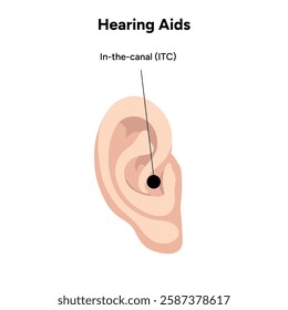 Hearing aids in-the-ear ITE. in-the-canal (its), low-profile. Microphone technology listening for deaf people