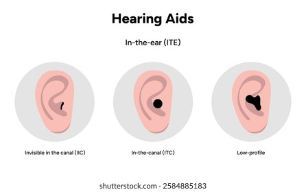 Hearing aids in-the-ear ITE. Invisible in the canal IIC, in-the-canal (its), low-profile. Microphone technology listening for deaf people