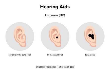 Hearing aids in-the-ear ITE. Invisible in the canal IIC, in-the-canal (its), low-profile. Microphone technology listening for deaf people