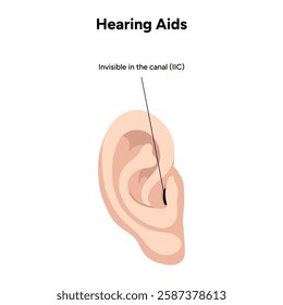 Hearing aids in-the-ear ITE. Invisible in the canal IIC. Microphone technology listening for deaf people