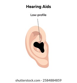 Hearing aids in-the-ear ITE, low-profile. Microphone technology listening for deaf people